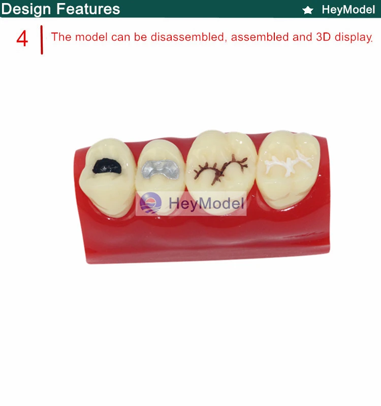 Heymodel зубы ямы и трещины Модель Стоматологическая dentition модель