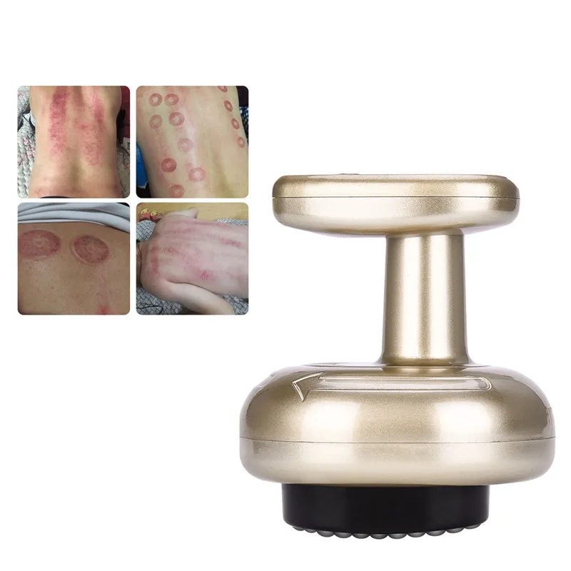 Electric Cupping Stimulate Acupoint Detoxification Massager Guasha Scraping Heat Massage Negative Pressure Acupuncture Therapy 0