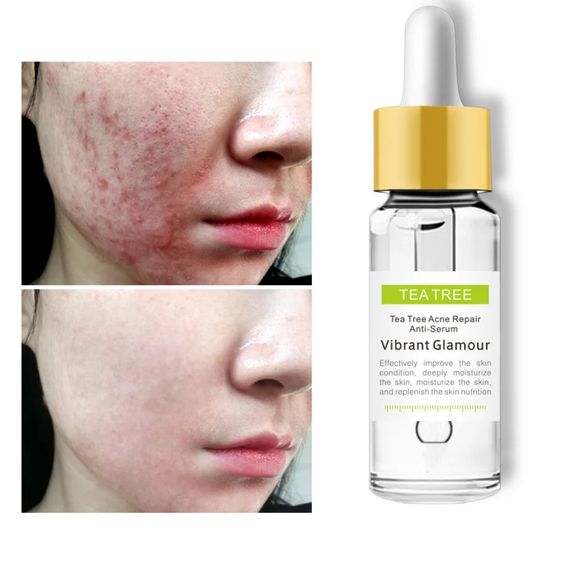 

Tea Tree Repair Face Serum Acne Scar Shrink Pores Face Serum Eliminates Acne Treatment Serum Oil Control Essence
