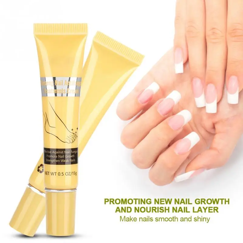 15g Natural Nail Care Cream Fungus Removal Cream Herbal Deep