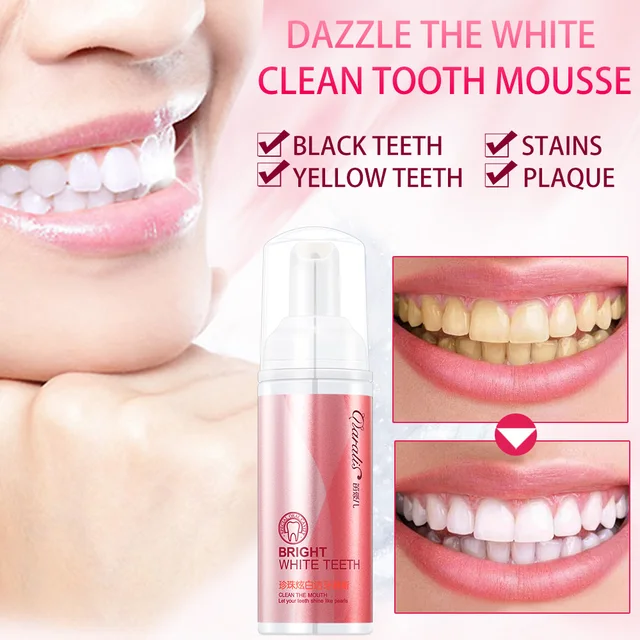 Bad Breath Treatment >> Daralis Deare Dazzle White Teeth Dry Mouth Spray Oral Moisturizer Bad Breath Treatment >> Daralis Deare Dazzle White Teeth Dry Mouth Spray Oral Moisturizer