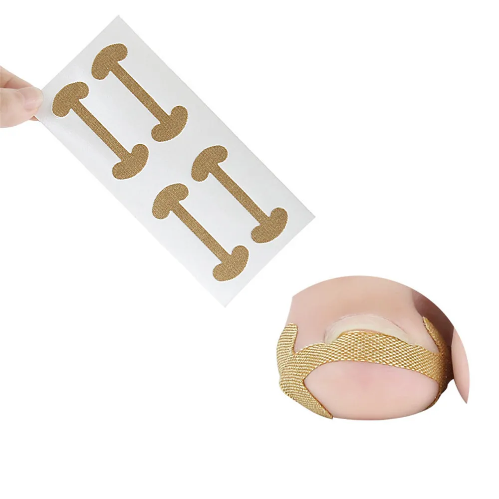 8 шт = 2 упаковки вросших ногтей Корректор ногтей наклейки лечение пароникьи восстановление корректор для педикюра Инструменты для ухода за ногтями