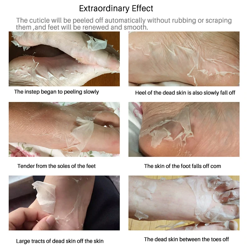 exfoliating dead skin on legs