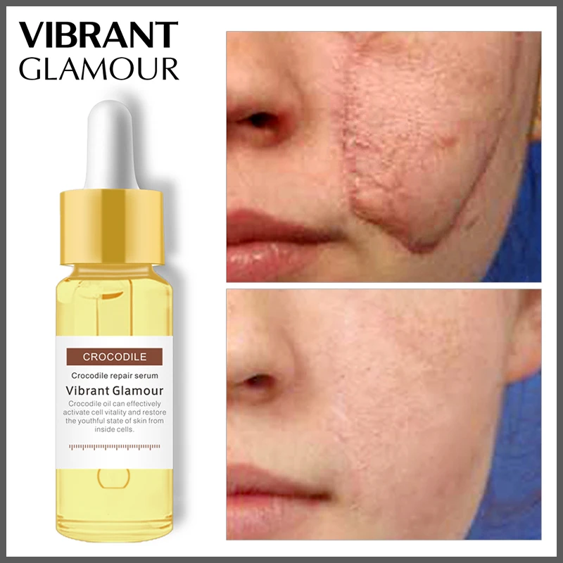 VIBRANT GLAMOUR Crocodile Dispel Scar Repair Face Serum Remove Acne Scar Stretch Marks Treatment Skin Lightening Whitening Care