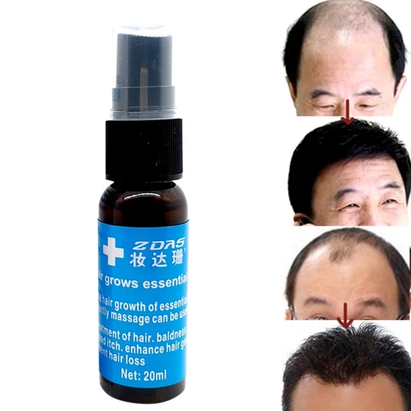 100% Effective Hair Growth Liquid Spray Anti Hair Loss for Hair Regrowth Dry Hair Repair Moisturizer Treatment K2