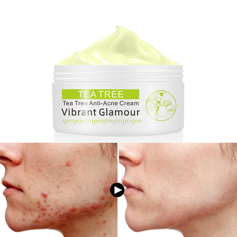 

VIBRANT GLAMOUR Tea Tree Anti-acne Cream Acne Scar Face Cream Shrink Pores Facial Eliminates Acnes Cream Oil control Repair Spot