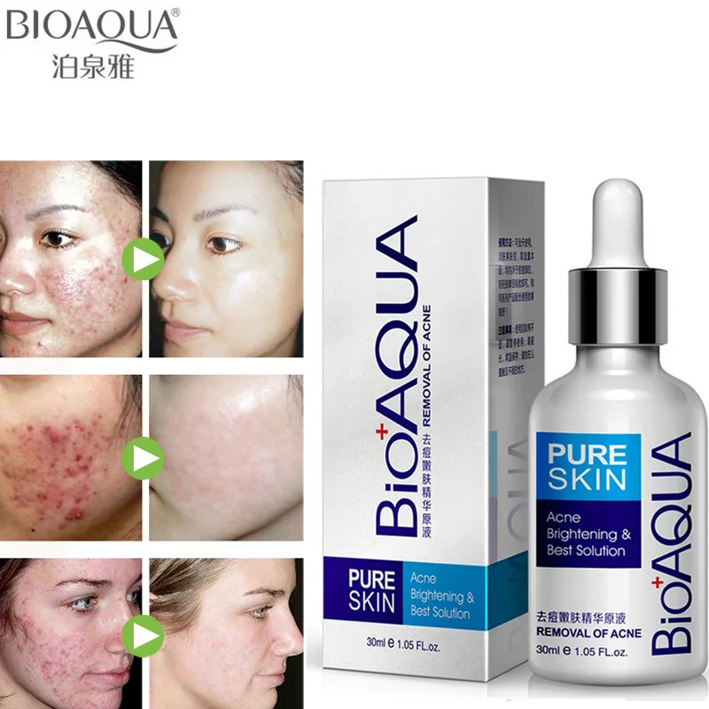 

BIOAQUA Skin Care Facial Serum Acne Treatment Acne Scar Remover Liquid Facial Whitening Moisturizing Essence Skin Care 30ml