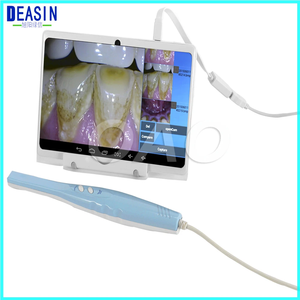 Стоматологическая CF-688A внутриоральная камера с USB+ OTG стоматологическая камера для телефона android и планшета Android медицинское оборудование