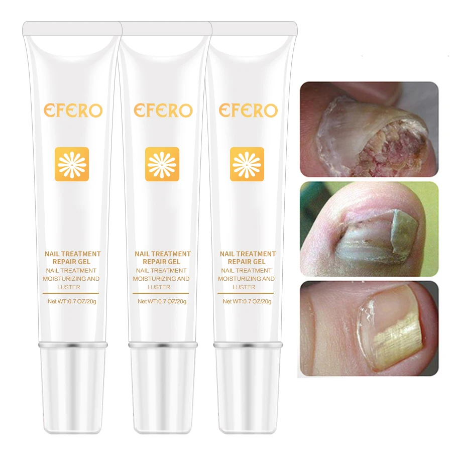 

EFERO Nail Repair Essence Serum Fungal Nail Treatment Remove Onychomycosis Nails and Toes Whitening Nourishing Hand Foot Care