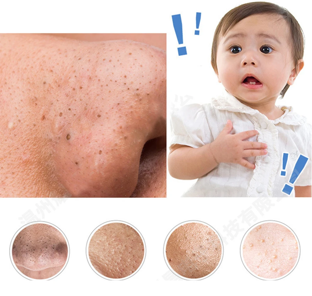black head removal moisturising machine (3)