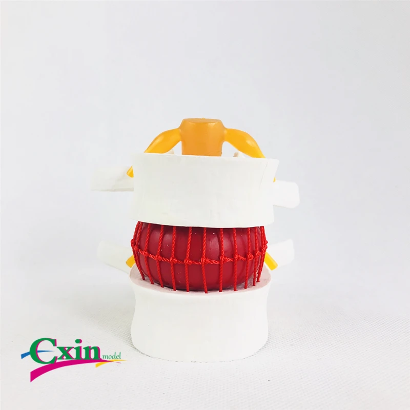 Human white lumbar intervertebral disc demonstration model Lumbar vertebrae anatomy Medical teaching | Канцтовары для офиса и