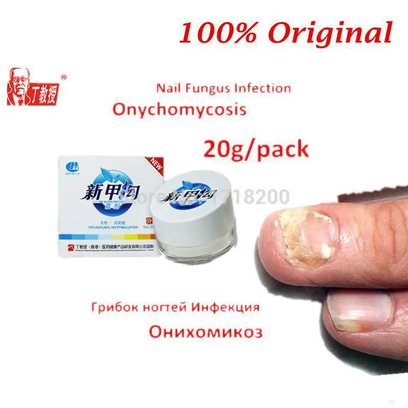 2pcs Nail Treatment Cream For Onychomycosis Paronychia Cures / Anti