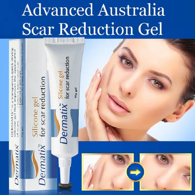 

Australia Dermatix Scar Reduction advanced topical transparent Silicone Gel for prevent scars, reduce prominent immature scars