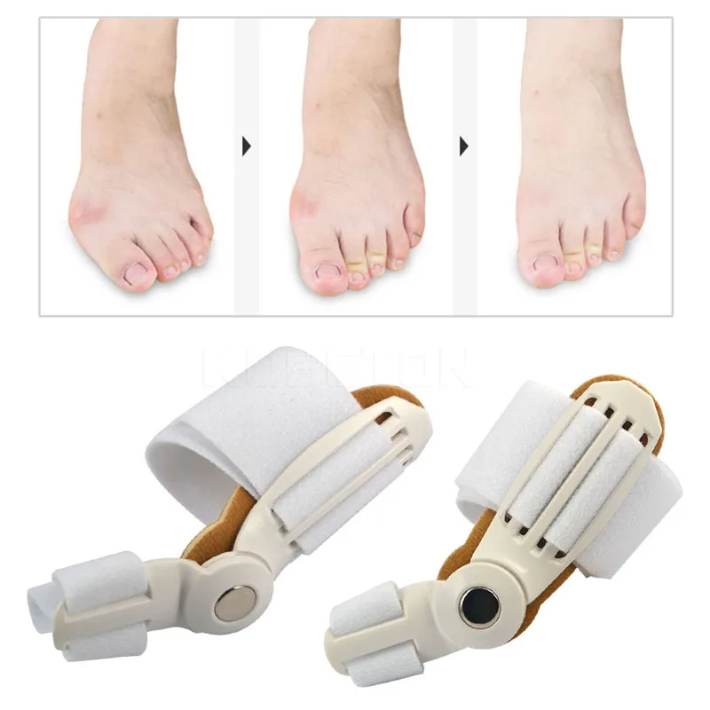 

Big Toe Equipment Splint Straightener Corrective Toe Correction Foot Pain Relief Thumb Care Daily Correction A0071XX