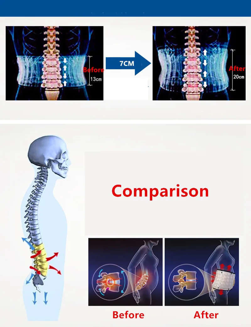 Поясничный Электрический пояс с воздушным давлением, надувная тяга, предотвращающая выздоровление, поясничный позвонок, которая снимает боль