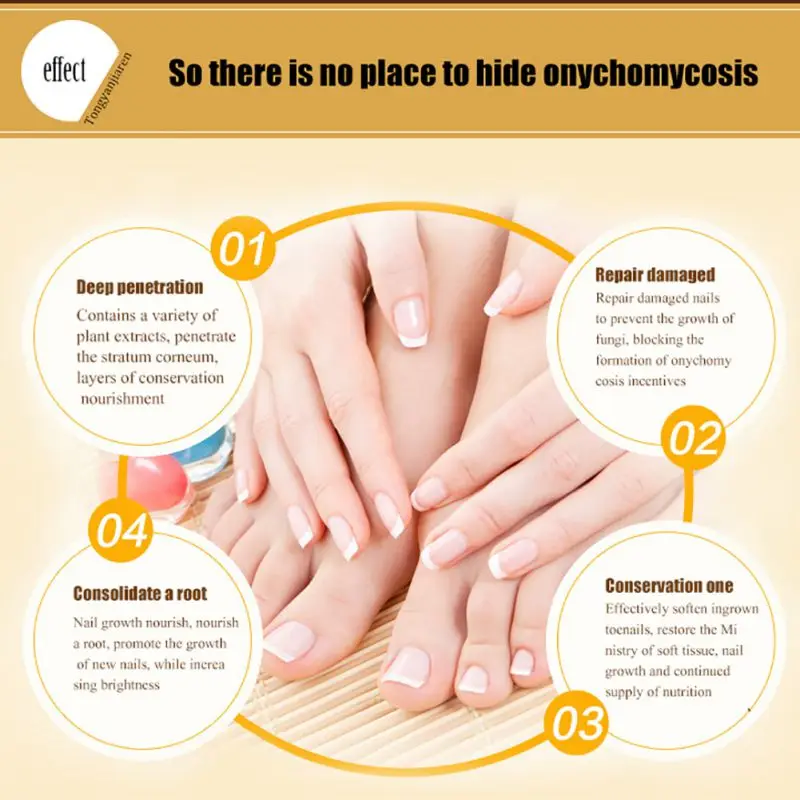 Skin Care Nail Treatment Essential Oil Hand and Foot Whitening Toe Nail Fungus Removal Infection Nail Care Liquid Beauty Skin Care Nail Treatment Essential Oil Hand and Foot Whitening Toe Nail Fungus Removal Infection Nail Care Liquid Beauty