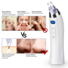 Уход за кожей, вакуумный удалитель черных точек, Удаление прыщей, вакуумный всасывающий инструмент для очистки лица, Алмазная дермабразия для лица