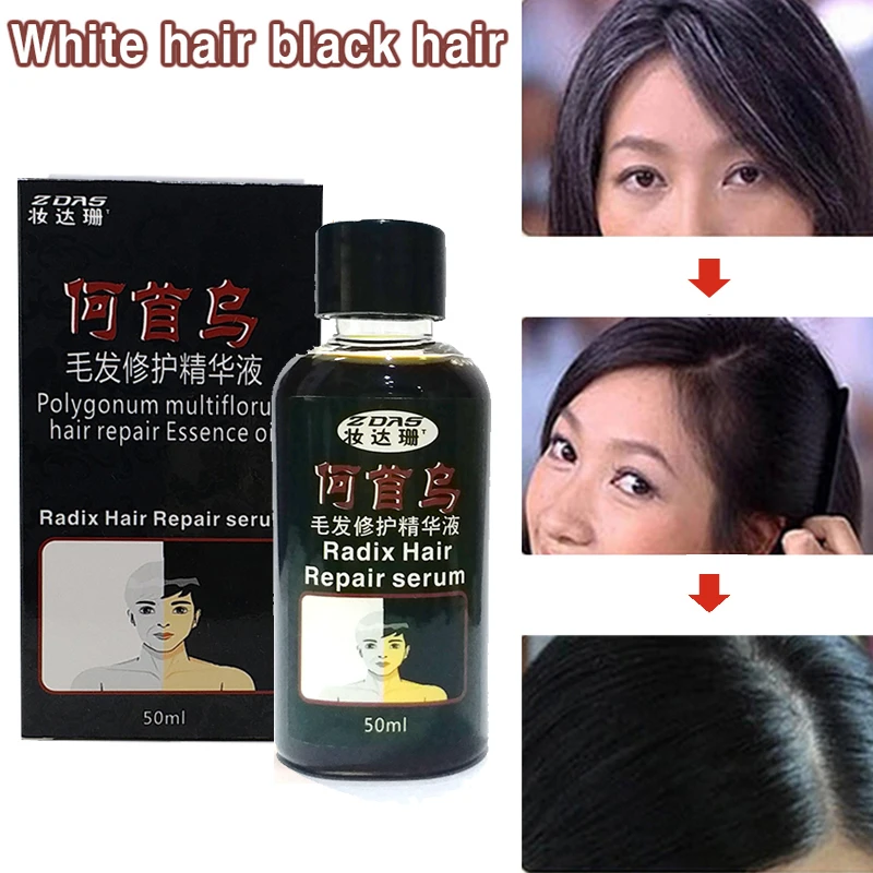 Китайская медицина, жидкость для роста, дополнительная настойка, средство против выпадения волос, жидкое эфирное масло, сыворотка для ухода за волосами, 50 мл 3
