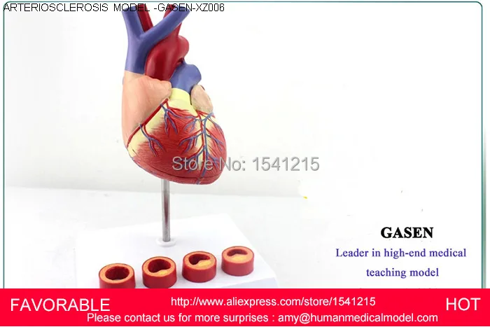 HUMAN ANATOMICAL HEART,ANATOMY VISCERA MEDICAL ORGAN MODEL EMULATIONAL ,HUMAN HEART ARTERIOSCLEROSIS MODEL -GASEN-XZ006 HUMAN ANATOMICAL HEART,ANATOMY VISCERA MEDICAL ORGAN MODEL EMULATIONAL ,HUMAN HEART ARTERIOSCLEROSIS MODEL -GASEN-XZ006