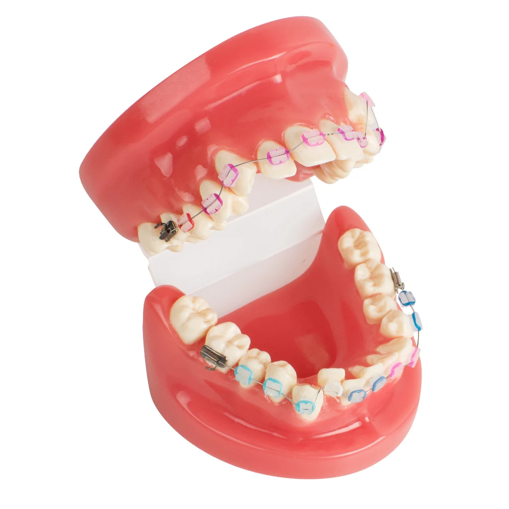 

Dental Orthodontics Typodont Dental Teeth Study Model With Ceramic Brackets