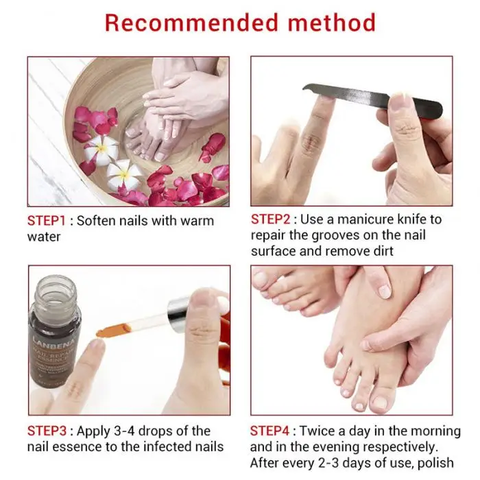 Удаление грибка здоровый ремонт эссенция для ногтей инструменты для лечения с пилка маникюрная пилка защита ноги эфирное масло для ухода за кожей сыворотка