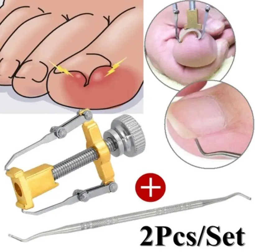 

2Pc/Set Ingrown Foot Care Tool Toe Nail Correction Nippers Clipper Cutters Dead Skin Dirt Remover + Paronychia Podiatry Pedicure