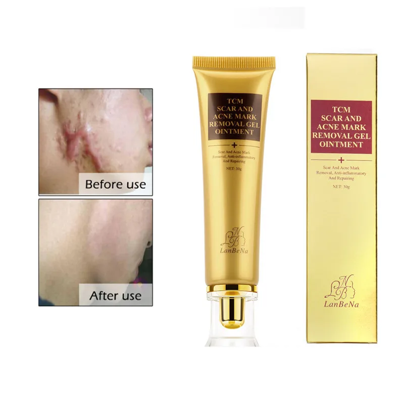 LANBENA Acne Scar Removal Cream Skin Repair Face Cream Acne Spots Acne Treatment Blackhead Whitening Cream Stretch Marks 30ml LANBENA Acne Scar Removal Cream Skin Repair Face Cream Acne Spots Acne Treatment Blackhead Whitening Cream Stretch Marks 30ml