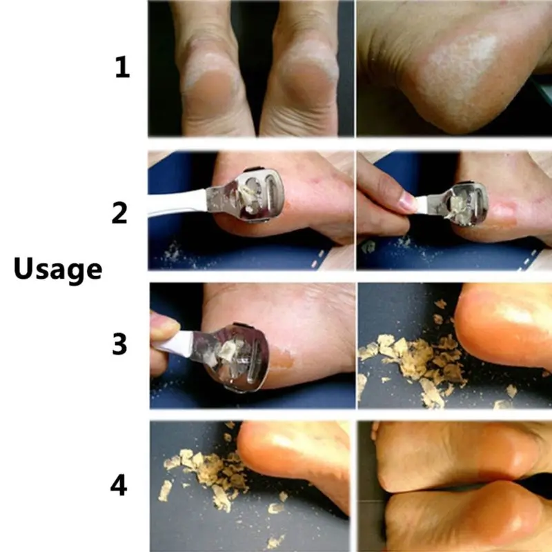 Профессиональный Нержавеющая сталь мозоли, ороговелости терка для ступней Пластик ручка рашпили для ухода за ногами электрическая пемза для пяток скруббер для педикюра, инструмент для ухода за ногтями
