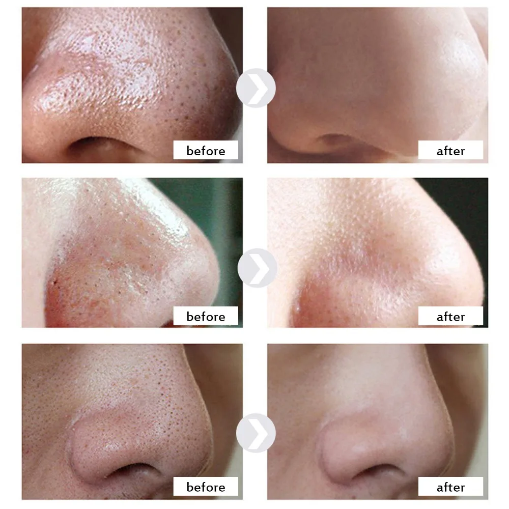 30g Blackhead Remover Nose Mask Pore Strip Black Mask Peeling Acne Treatment Deep Cleansing Face Mask Oil Control Skin Care