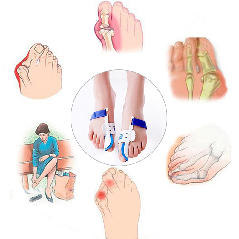 1Pair Beetle-crusher Bone Ectropion Toes Separator Hallux Valgus Corrector Night Foot Care Tools Orthotics Braces Bunion Device
