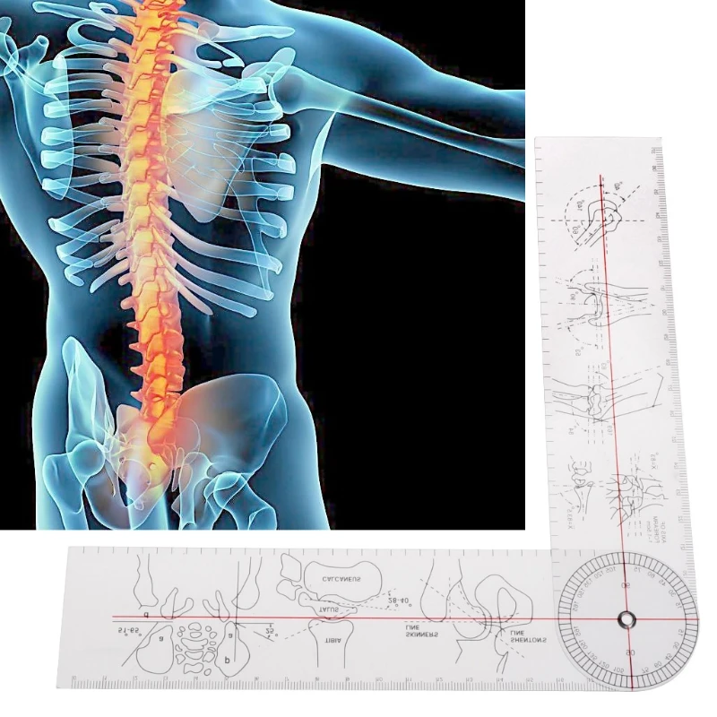 Медицинский обучающий Гониометр, угловая медицинская линейка, правила сустава, ортопедический инструмент, инструменты из пластика