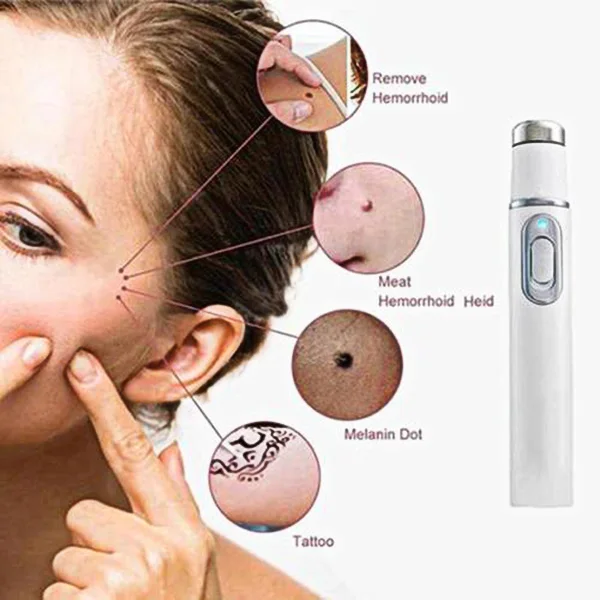 Skin Spots Acne Scar Pimple Removal Pen Beauty Treatment Machine Skin Repairing Device H7JP