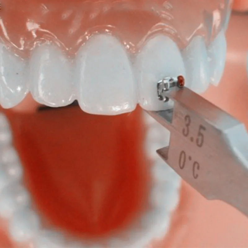 Orthodontic Braces,Dental Orthodontic Bracket Positioning Gauge Type 3