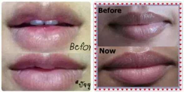新しいピンク唇クリーム美白削除煙唇バーム送料無料 Pink Lips Lip Lightening Creamlip Lightening Balm Aliexpress 新しいピンク唇クリーム美白削除煙唇バーム送料無料 Pink Lips Lip Lightening Creamlip Lightening Balm Aliexpress