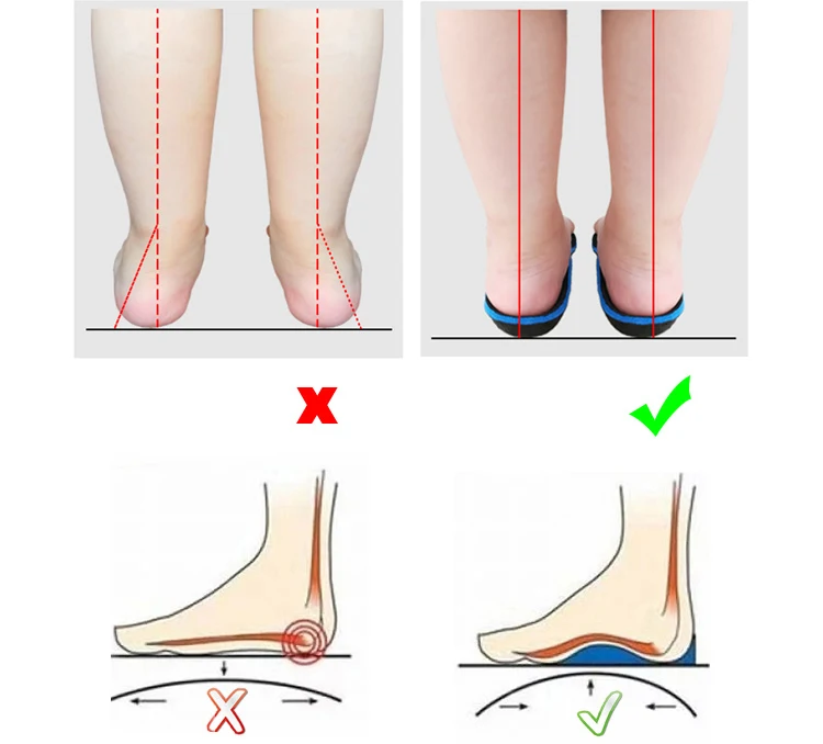 Ortopédicos para Crianças Função de Correção de Alta Qualidade para Meninas e Meninos Botas de Apoio de Tornozelo de Volta Sapatos Alta 10 High Quality Mamãe e Bebê