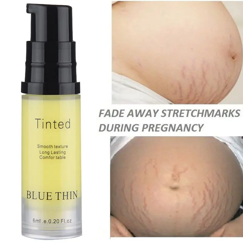 

6ML Stretch Marks Repair Cream Scar Acne Removal Streaks Fat Creme Striae Gravidarum Treatment Anti-Wrinkle Skin Care Lotion