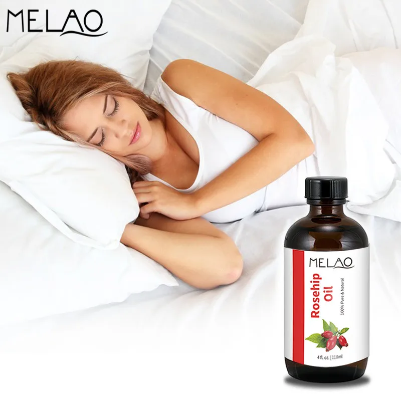 Jual Melao 100% Murni Organik Rosehip Minyak Pelembab Menyembuhkan Kulit Kering   Garis Halus Rose Benih Minyak untuk Kulit Wajah minyak Pijat 118 Ml