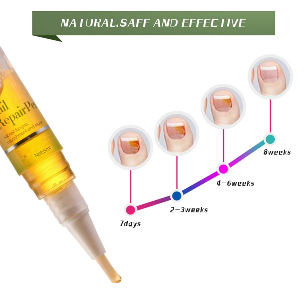 5 мл ручка для ремонта грибковых ногтей эффективная антигрибковая инфекция ногтей биологический ремонт восстанавливает здоровый уход за ногтями ног TSLM2