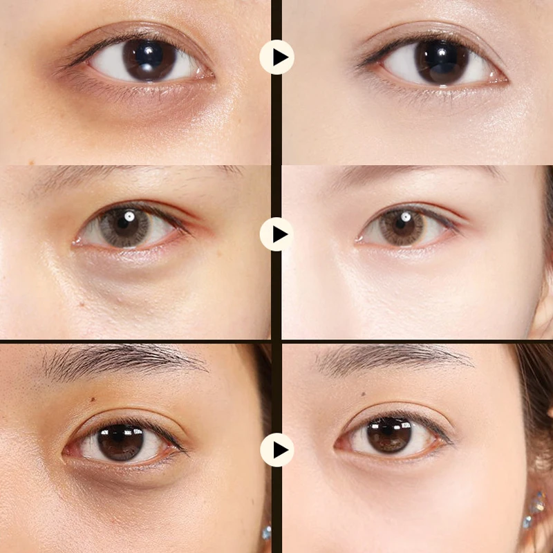 Эффект от патчей под глаза. Глаза после патчей. Эффект до после после патчей. Лицо до и после патчей. Патчи эффект.