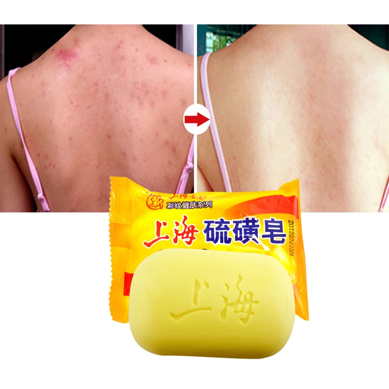 

Shanghai sulfur soap oil-control acne treatment blackhead remover soap 90g Whitening cleanser Chinese traditional Skin care