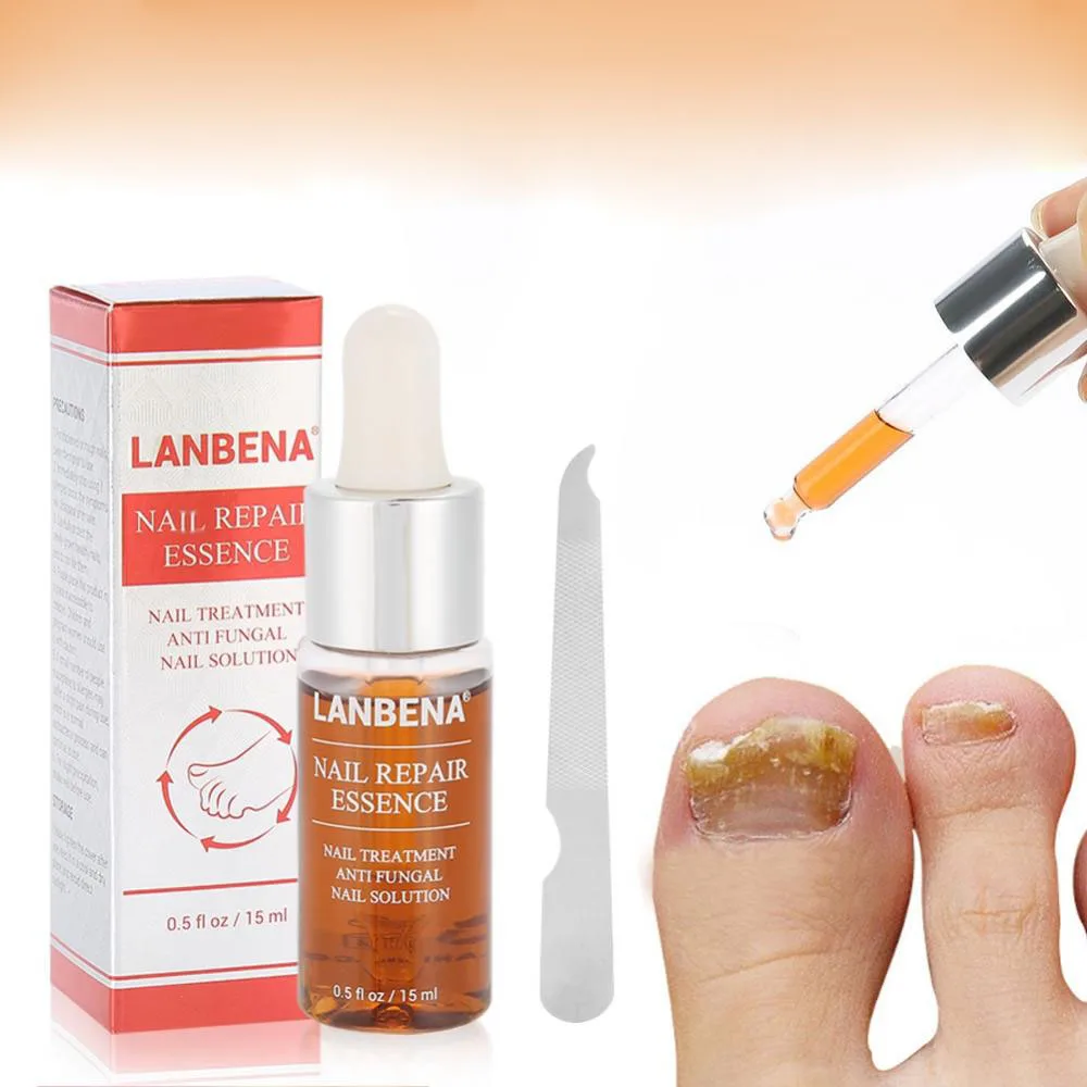 

LANBENA 15ml Nail Repair Essence Serum Fungal Nail Treatment Remove Onychomycosis Hands And Feet Care Of Toe Nail Nourishing