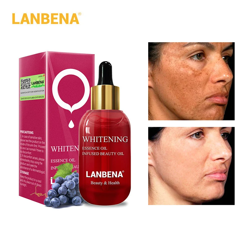 LANBENA تبييض زيت طبيعي غرست الجمال النفط حب الشباب البقع الندوب النمش إزالة الجلد مملة مكافحة الشيخوخة الجمال العناية بالبشرة!