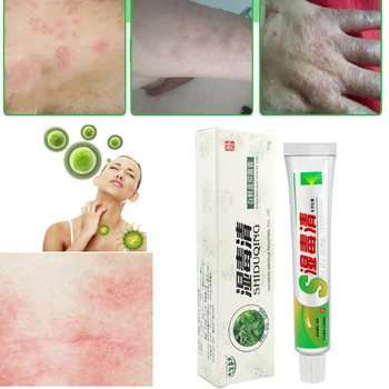

20g Natural Chinese Medicine Herbal Anti Bacteria Cream Psoriasis Eczema Ointment Treatment High Quality Herbal Cream D373