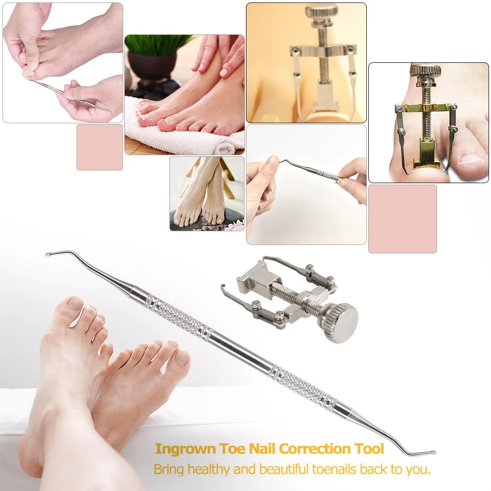 Stainless Steel Ingrown Toe Nail Recover Correction Tool Pedicure