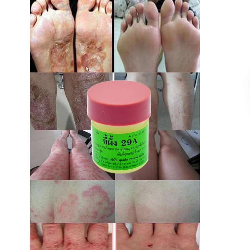 Pomada De La Psoriasis - Compra lotes baratos de Pomada De Pomada De La Psoriasis - Compra lotes baratos de Pomada De