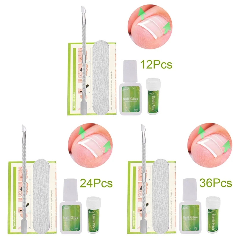 1 Набор, инструмент для коррекции вросших пальцев ног и педикюра, выпрямляющий пластырь для ухода за ногами