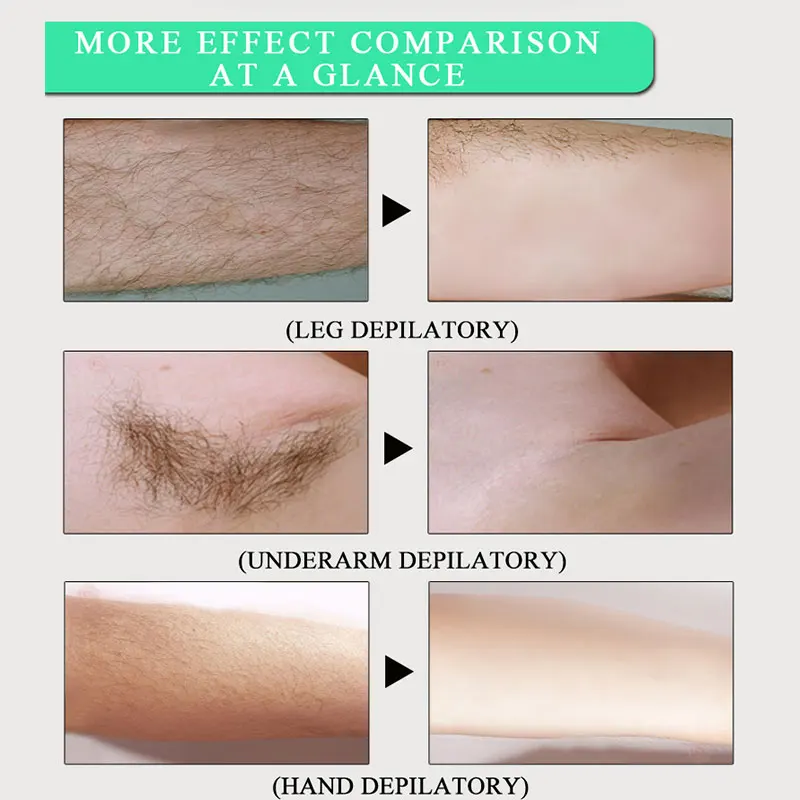 Травяной Крем Для Депиляции Тела не вызывает болезненных ощущений эффективный крем для удаления волос для Для мужчин Для женщин удаления для подмышек, для ног волосы отбеливающий Уход за изделием