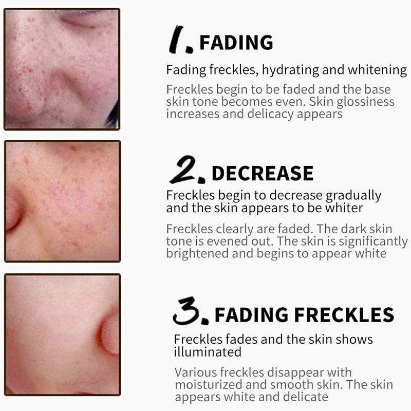 Collagen Face Cream Freckles Whitening Day Cream hyaluronic acid Anti-Aging Anti-Wrinkle Remove Spots Firming Brighten BEACUIR Collagen Face Cream Freckles Whitening Day Cream hyaluronic acid Anti-Aging Anti-Wrinkle Remove Spots Firming Brighten BEACUIR