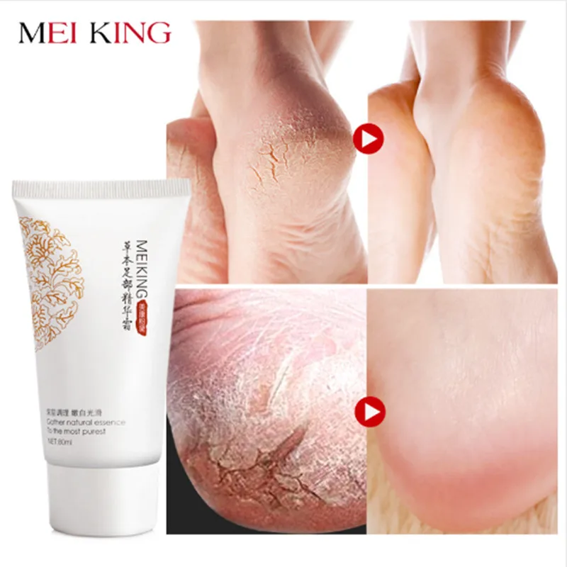 Buy MEIKING Baby Feet Care Deep Peeling for Feet