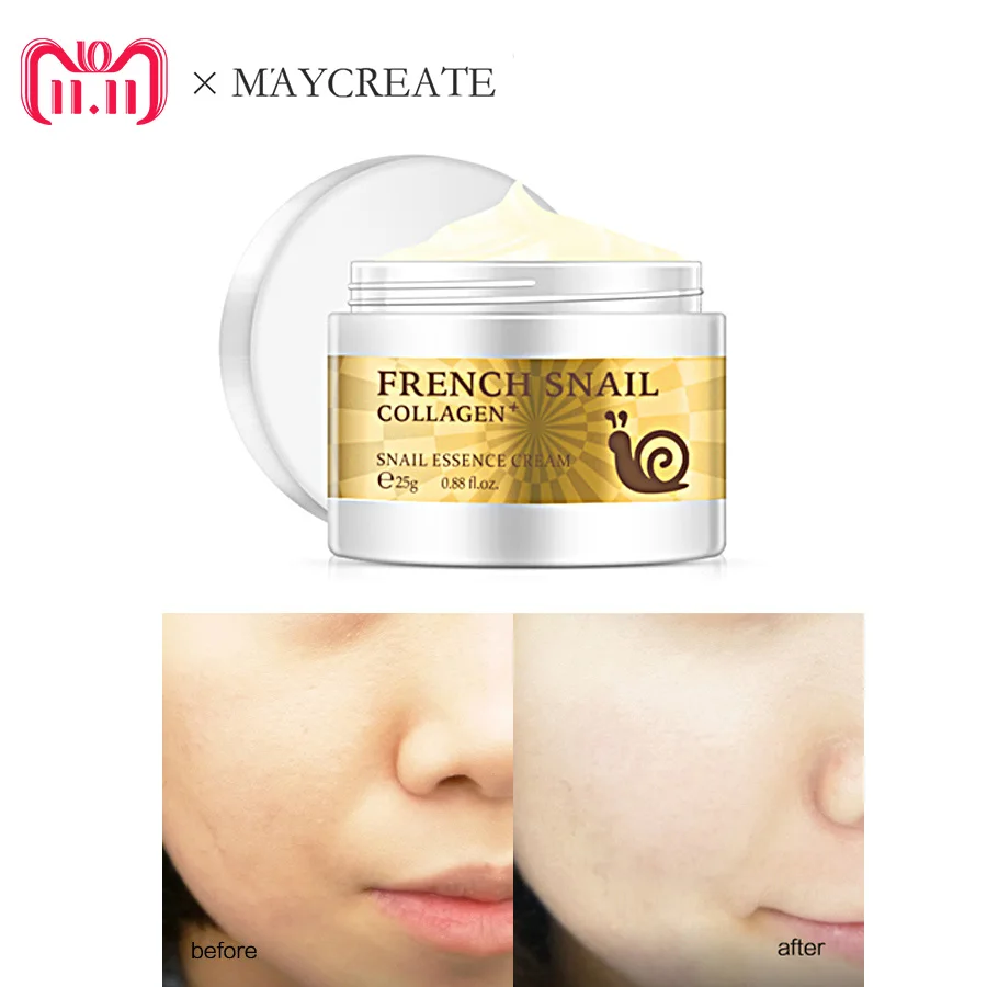 

MayCreate Snail Face Cream Acne Scar Removal Cream Skin Care For Face Whitening Cream Snail Stretch Marks Nourishing For Face
